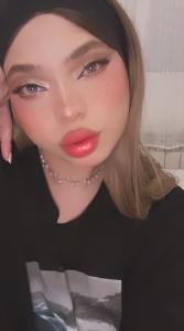 604100219: Transexual en Álava